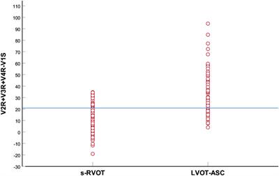 The R-S difference index: A new electrocardiographic method for differentiating idiopathic premature ventricular contractions originating from the left and right ventricular outflow tracts presenting a left bundle branch block pattern